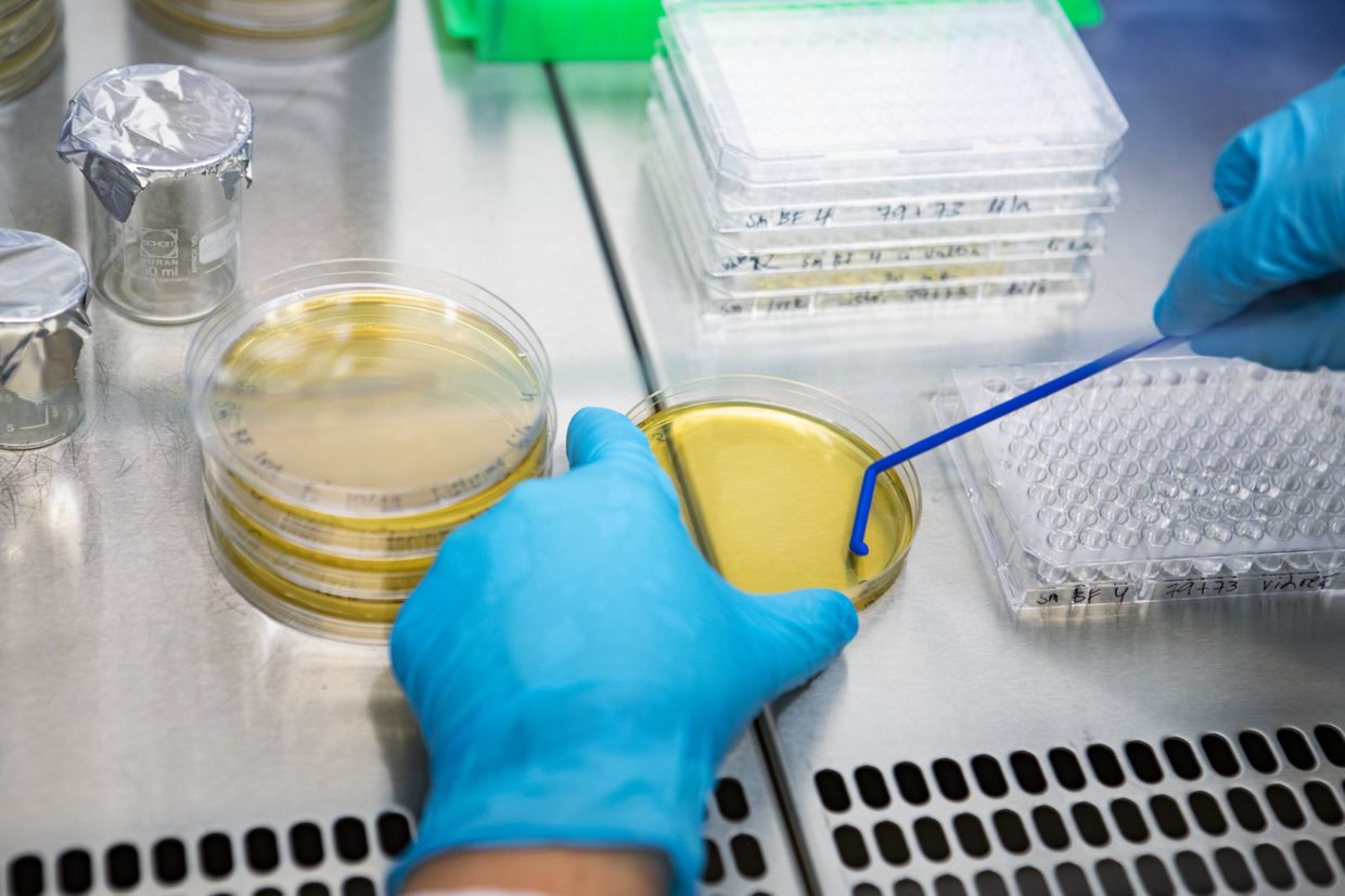 Mikon tarina: Työ Lumoral-tutkimuksen parissa auttaa ratkomaan maailman hammasterveyden haasteita